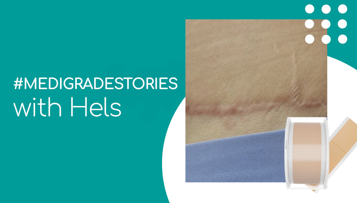 Scar roll Tape