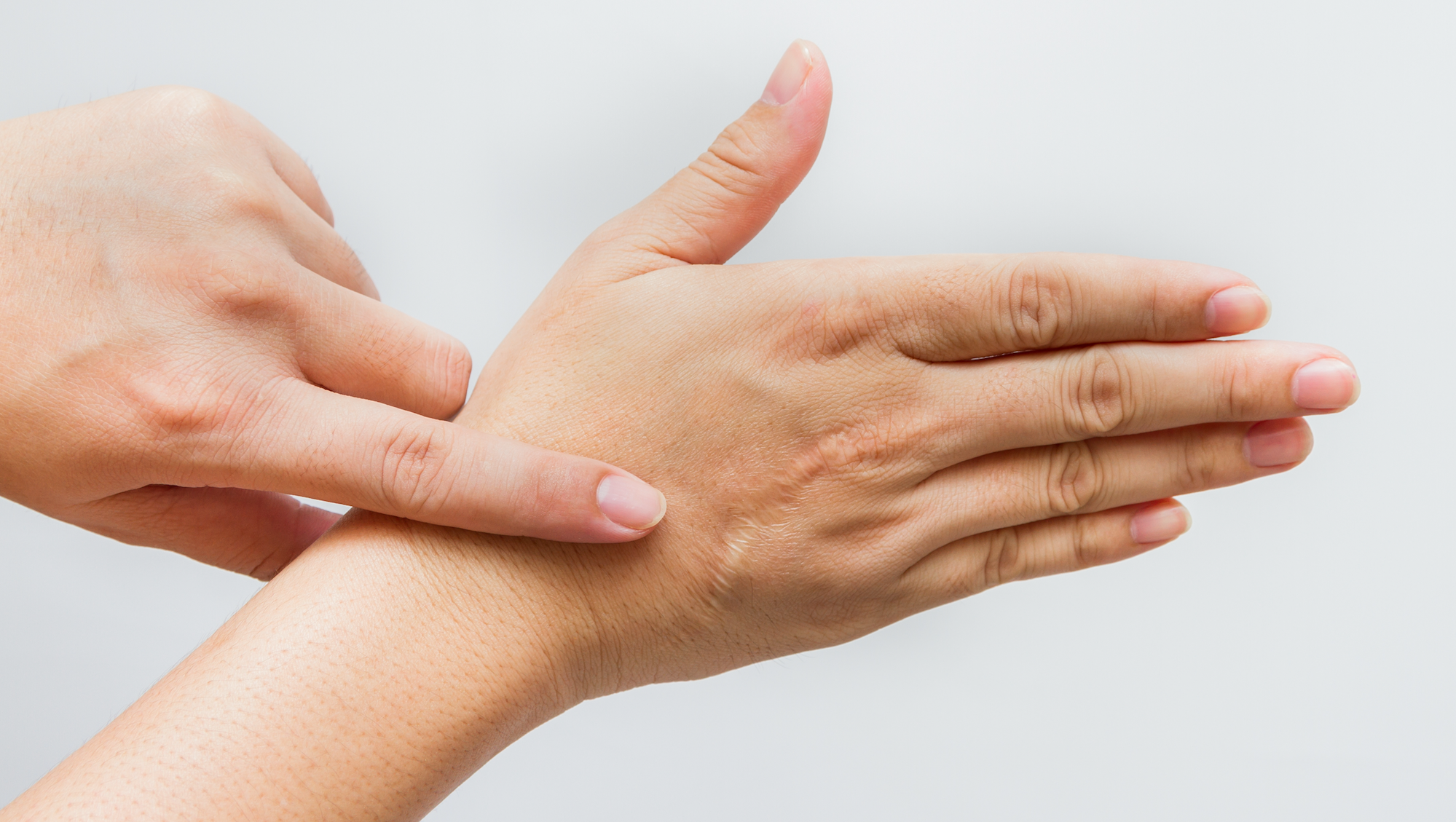 Advice On How To Reduce Your Scars