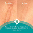 Load image into Gallery viewer, Before and After photo of a scar