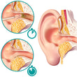 Load image into Gallery viewer, A diagram showing how the ear drops work in softening earwax
