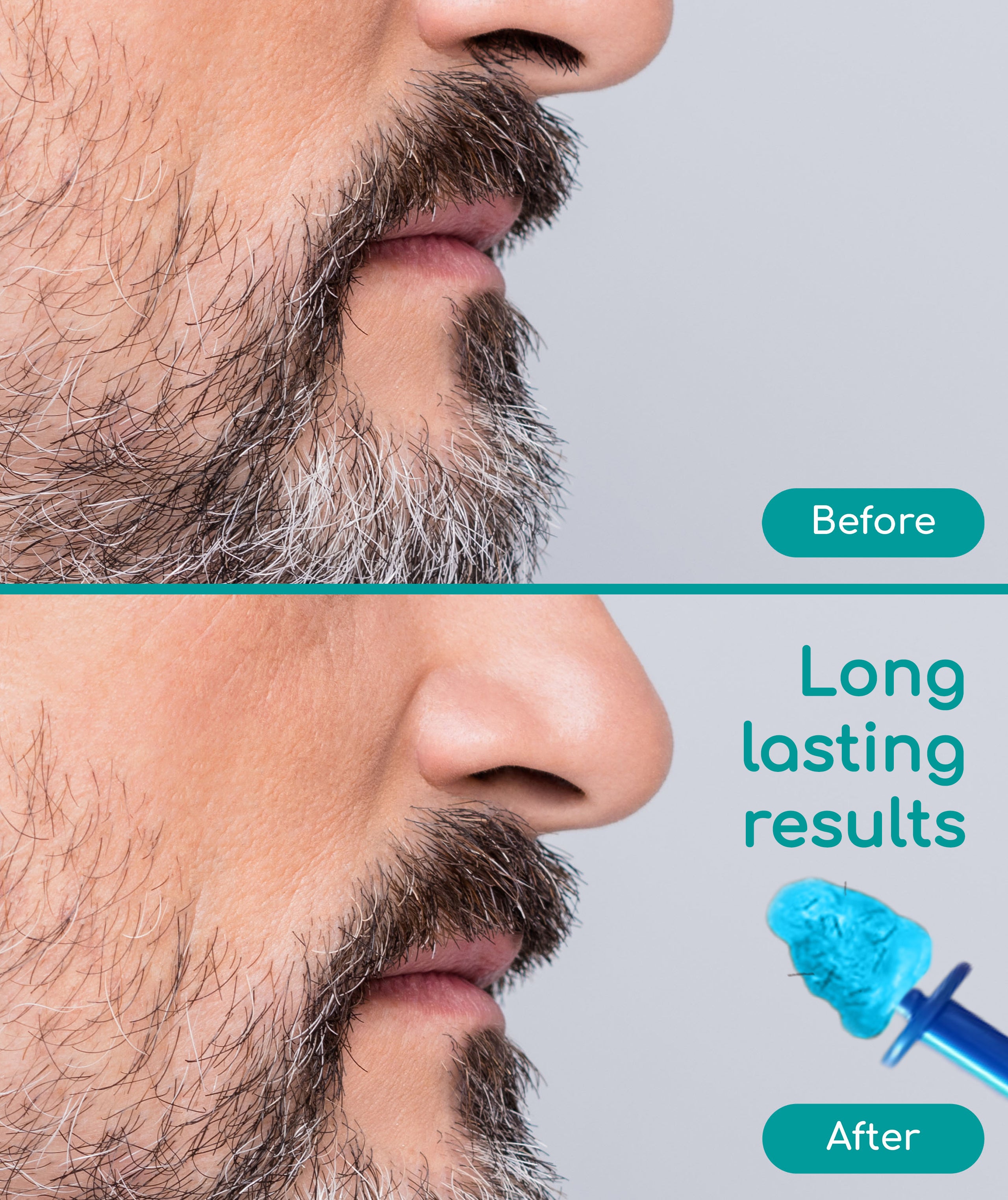 Medi Grade Nose Waxing Beads & Replacement Tips - for the Medi Grade Nose Waxing Pack