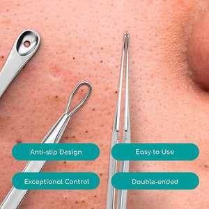 A close up of a person's face with 3 different blackhead remover tool