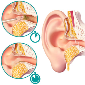A diagram showing how the ear drops work in softening earwax