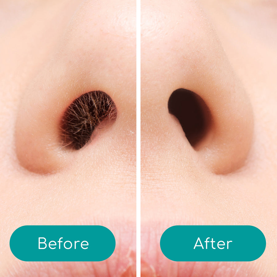 A nose before and after nose hair removal